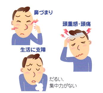 鼻閉の原因